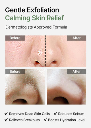 Heartleaf Bha Peeling Pad - 160 pads - photo 9 - Celimax