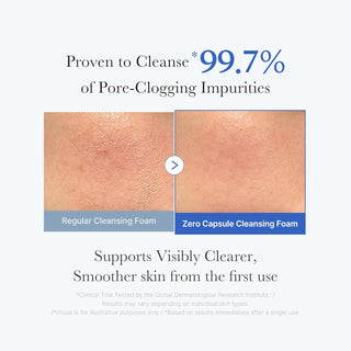 Zero Pore Clearing Capsule Cleansing Foam - AHA, BHA & PHA -120g
