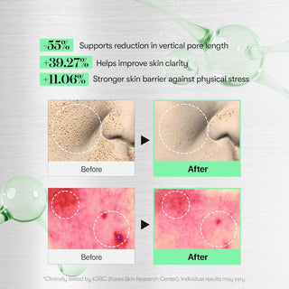 Cica Reedle Shot 100 - Sérum Visage Anti-Âge - 50 ml