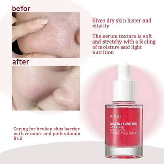Niacinamide 10 TXA 4 Dark Spot Removing Serum - 30 ml