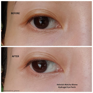 Hydrogel Eye Patch - with Bulgarian Rose Water - 60 Pieces - photo 12 - HEIMISH