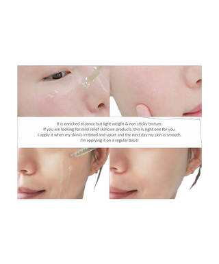 Skin Relief Essence - 30ml - detoure