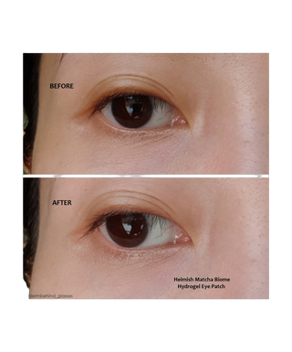 Hydrogel Eye Patch - with Bulgarian Rose Water - 60 Pieces - detoure