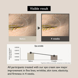 Black Rice Bakuchiol Eye Cream - 20 ml