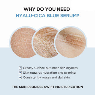 Madagascar Centella - Hyalu-Cica - Blue Serum